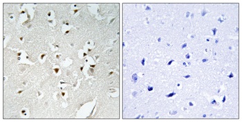 PMS1 antibody