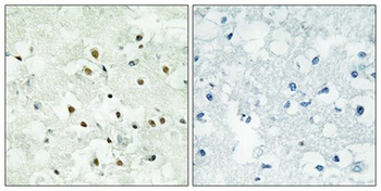 PMS2 antibody