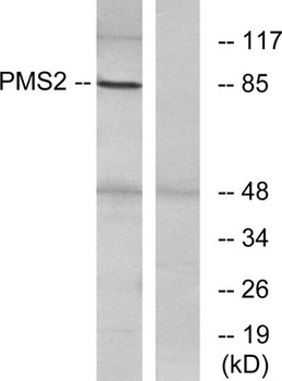 PMS2 rabbit pAb