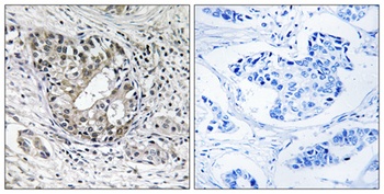 PNPase rabbit pAb