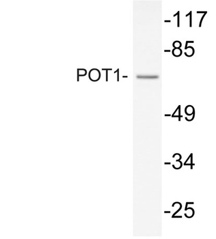 POT1 rabbit pAb