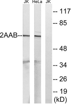 PP2A-A beta antibody