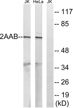 PP2A-Aβ rabbit pAb