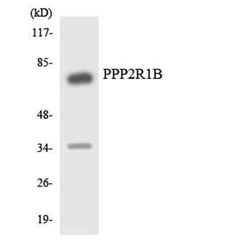 PP2A-A beta antibody