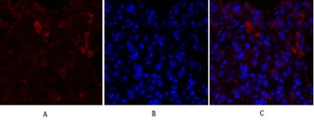 PPAR-gamma antibody