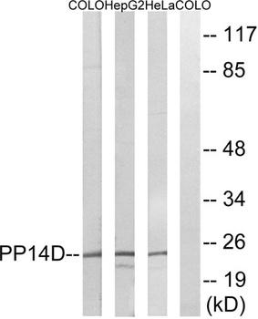 PPP1R14D rabbit pAb Antibody