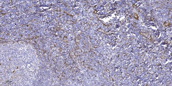 PPP1R14D rabbit pAb Antibody