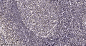 PPP2R3C antibody