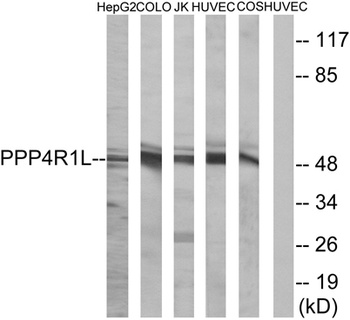 PPP4R1L rabbit pAb