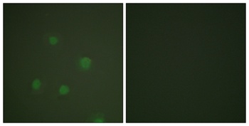 PR antibody