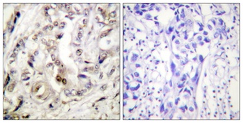 PR antibody