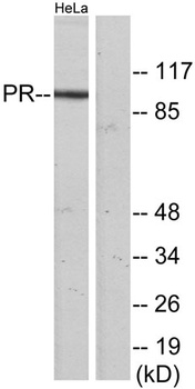 PR antibody