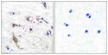 PRAF2 rabbit pAb Antibody