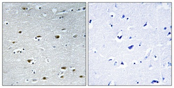 PRP19 rabbit pAb