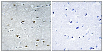 PRP19 antibody