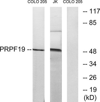 PRP19 rabbit pAb