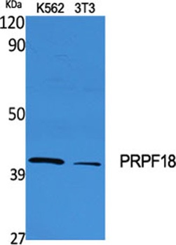 PRPF18 rabbit pAb