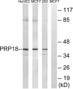 PRPF18 rabbit pAb