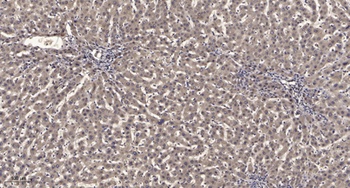 PRPF18 rabbit pAb