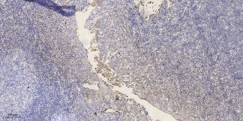 PRSS33 antibody