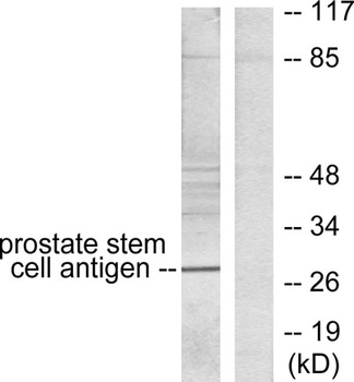 PSCA antibody