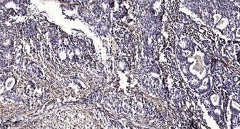 PSMC6 rabbit pAb