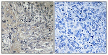 PSMD2 antibody