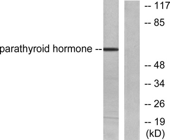 PTH rabbit pAb Antibody