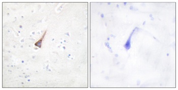 PTP1B rabbit pAb
