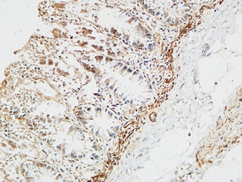 Ptx3 antibody