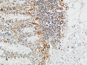 Ptx3 antibody