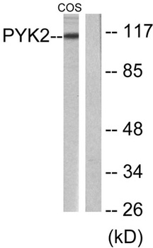 PYK2 rabbit pAb