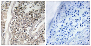 Rab 3 GAP p130 antibody