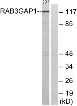 Rab 3 GAP p130 antibody