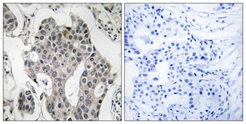 Rab 3 GAP p150 antibody