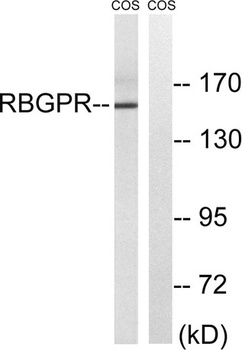Rab 3 GAP p150 antibody