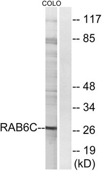 Rab 6C antibody