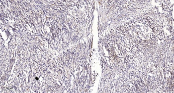 Rabenosyn-5 antibody