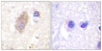 Rabphilin-3A rabbit pAb