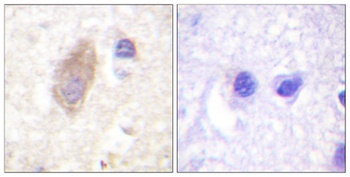 Rabphilin-3A antibody