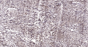 Rac GAP1 antibody