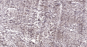 Rac GAP1 rabbit pAb