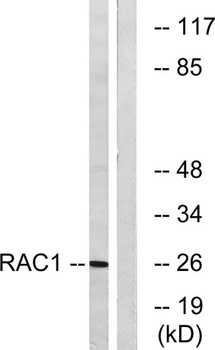 Rac1/2/3/CDC42 rabbit pAb