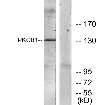 RACK7 rabbit pAb