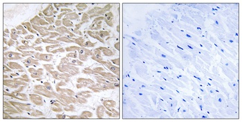 Rad GTPase antibody