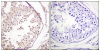 Rad52 antibody