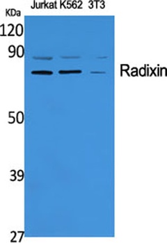 Radixin rabbit pAb Antibody