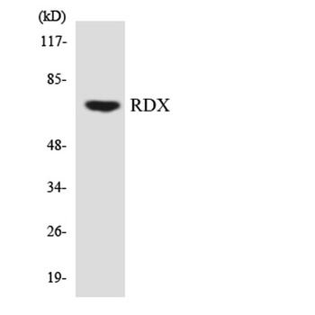 Radixin antibody