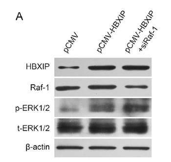 Raf-1 rabbit pAb Antibody