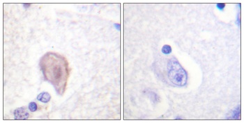 Raf-1 antibody